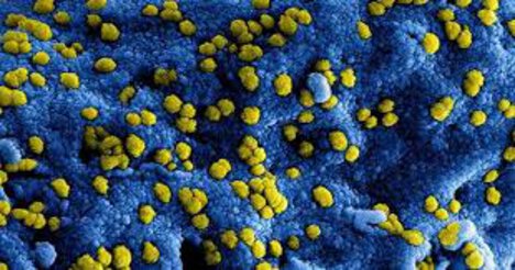 Onze maatregelen rondom het Coronavirus